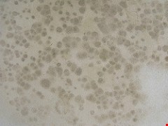 How Mold is Like a Zombie